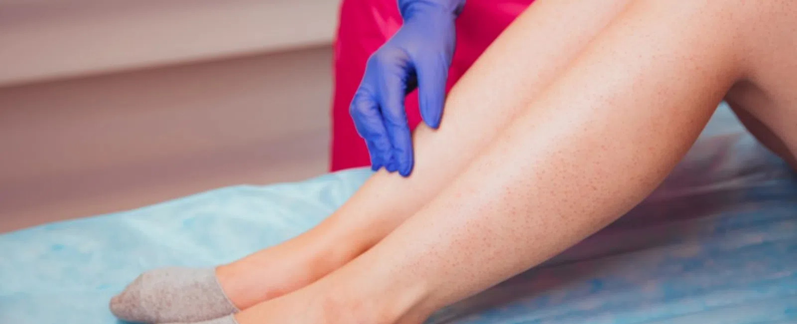 Does Vein Treatment Hurt? A Candid Breakdown of What to Expect