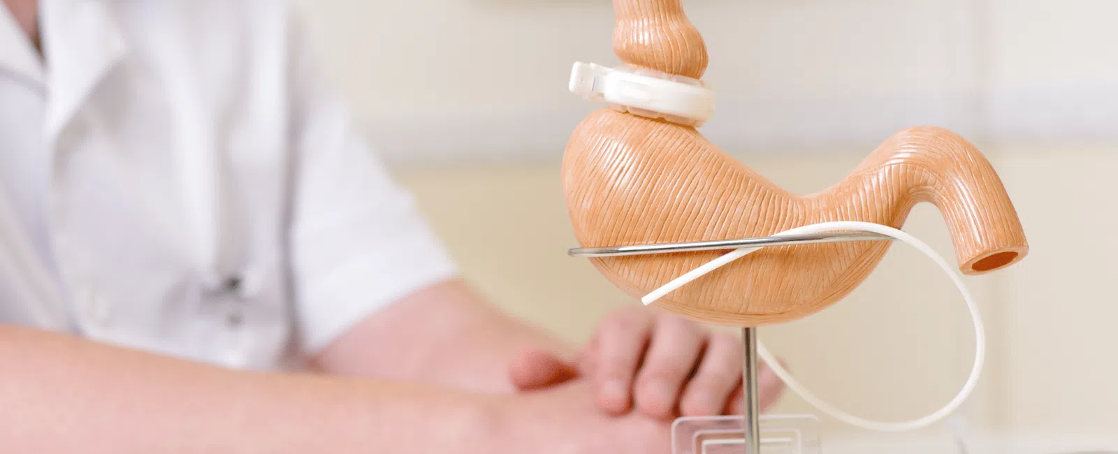 The Bariatric Surgery Process Explained