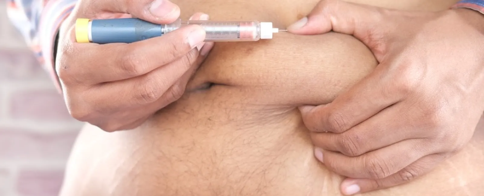 American Diabetes Month: Why Bariatric Surgery Is Your Strongest Tool Against High Blood Sugar
