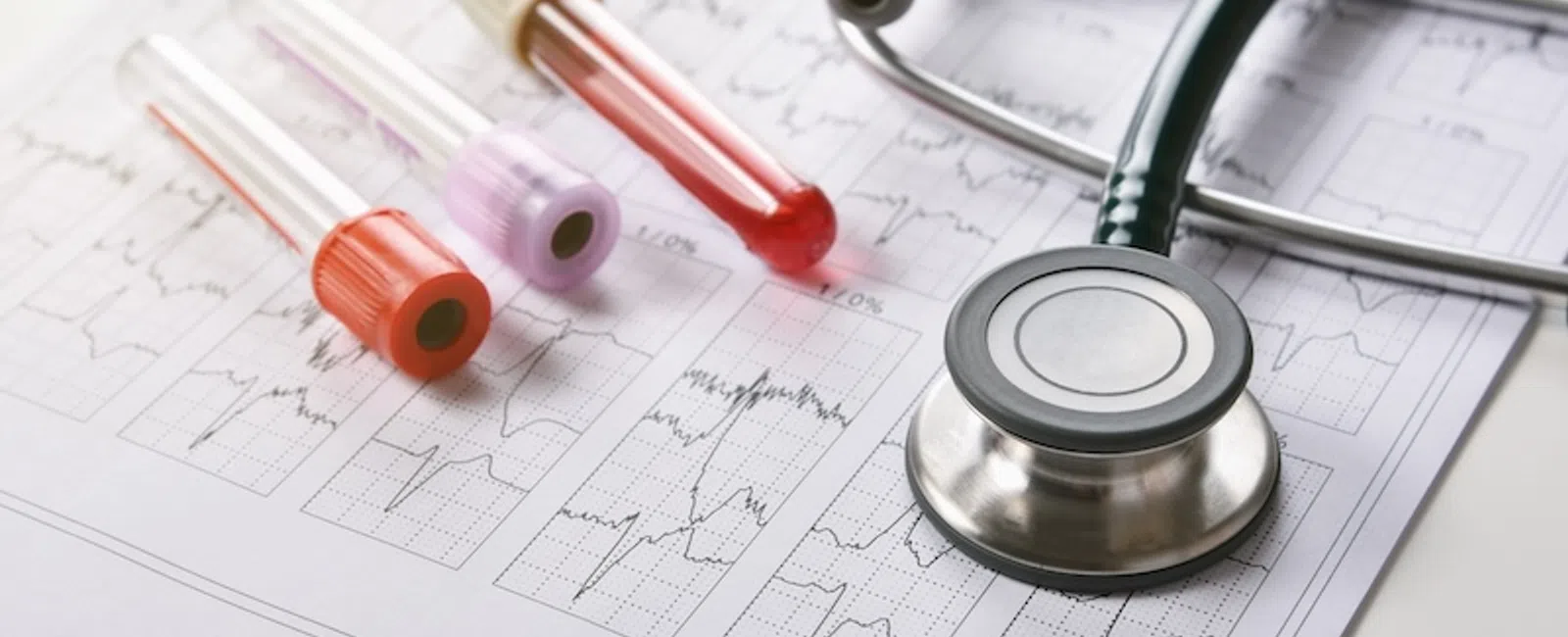 Inflammation Markers Dropped for the First Time in 20 Years: The Metabolic Side of Weight Loss Surgery