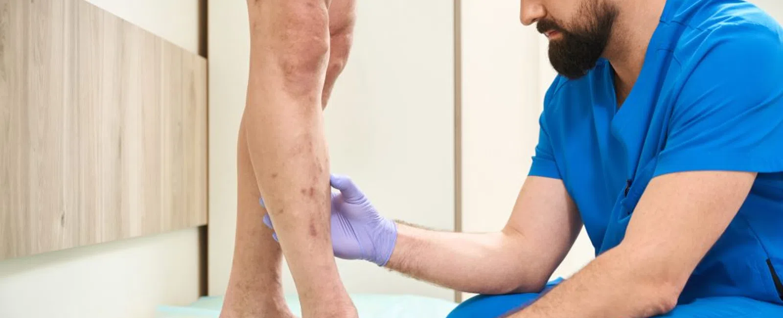 Can Venous Insufficiency Lead to Ulcers? Understanding the Connection Between Vein Disease and Wound Formation