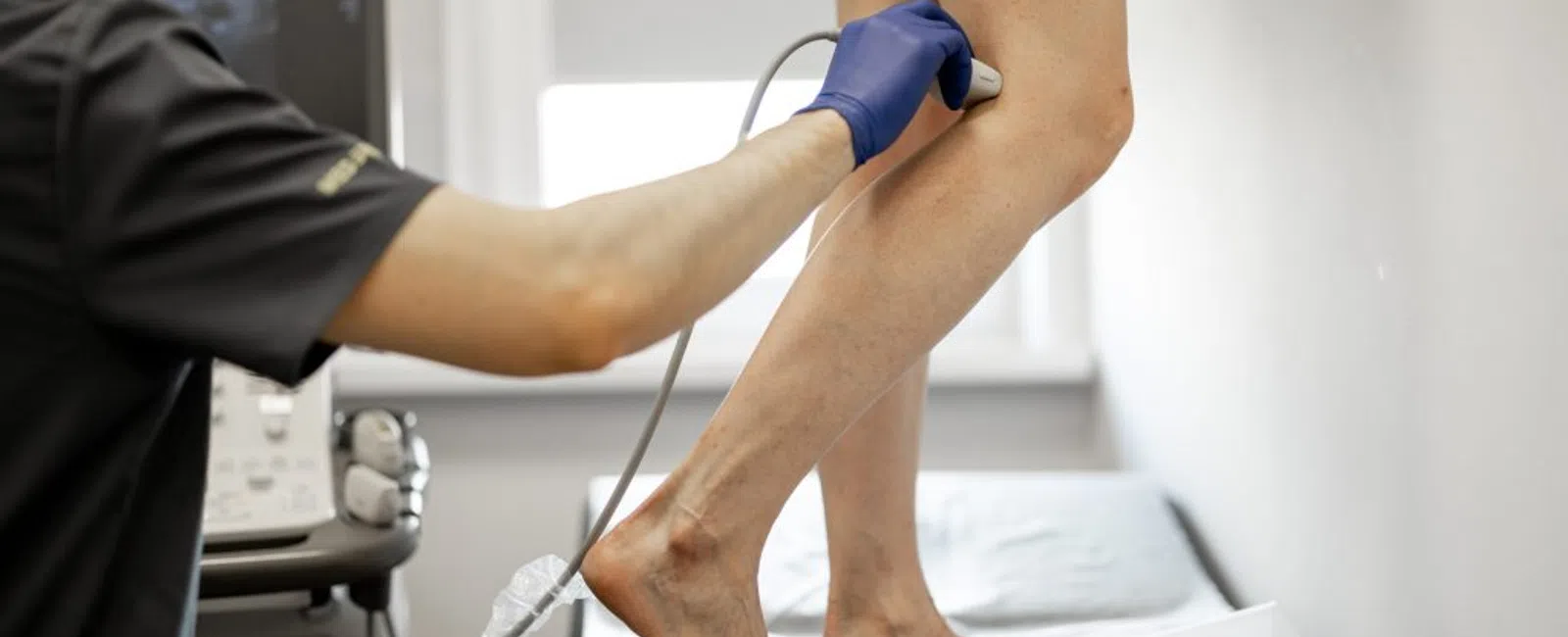 Is Vein Ablation Painful? Real Talk from Patients Who’ve Been There