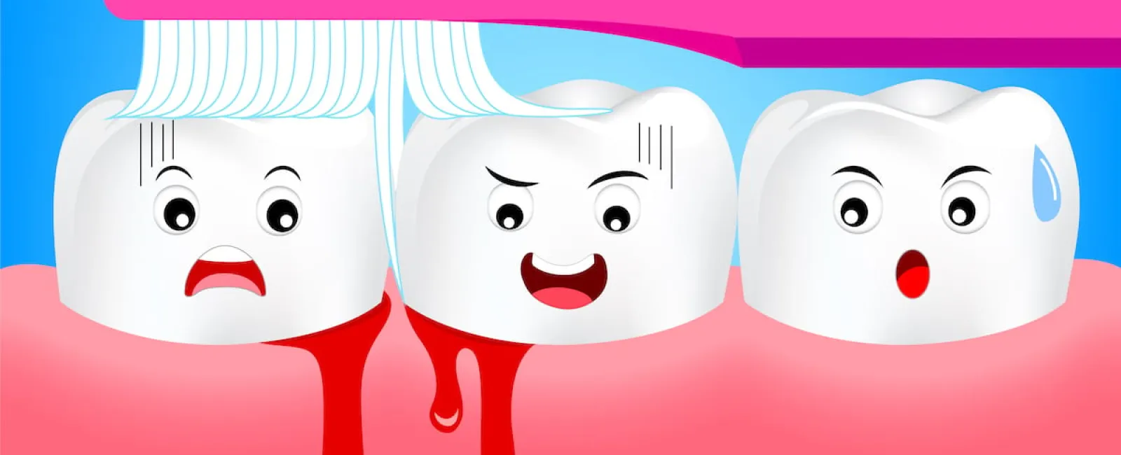 Causes of Bleeding Gums and Gum Disease
