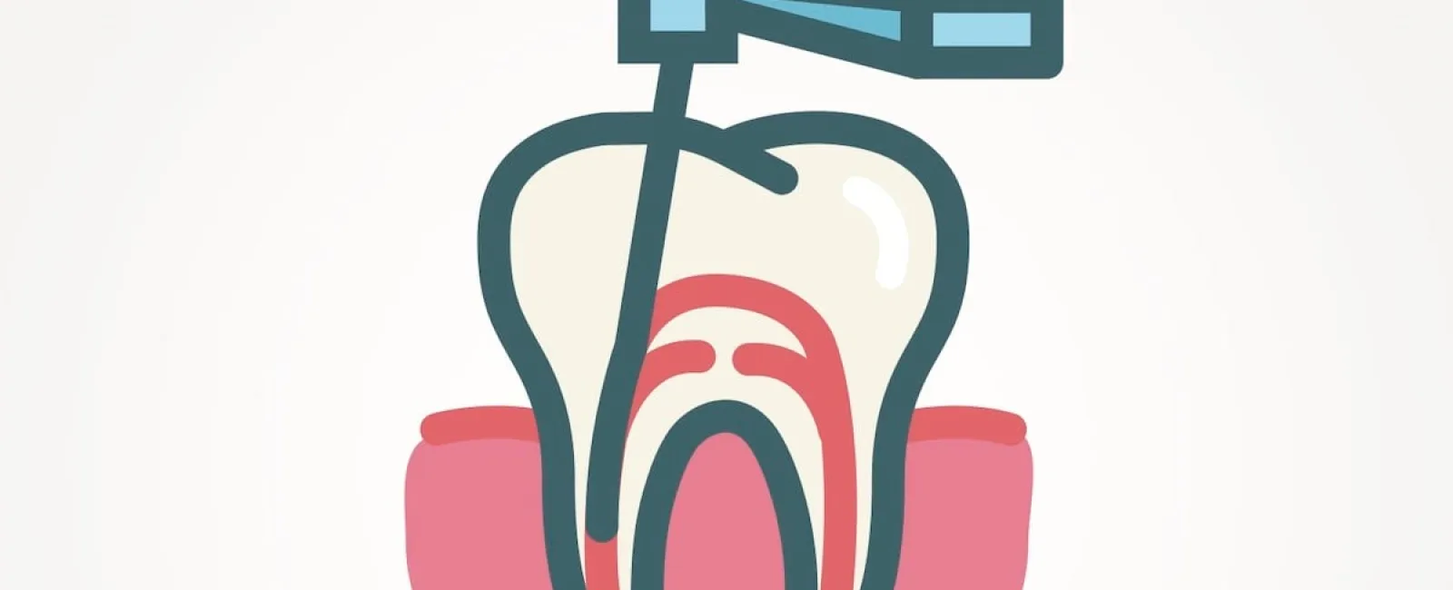 Uncover the Truth About Root Canal Treatment