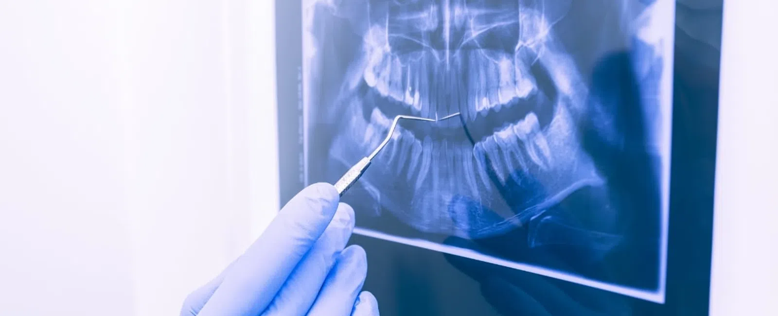 The Rise of AI in Dentistry: How Technology is Shaping Your Dental Experience in 2025