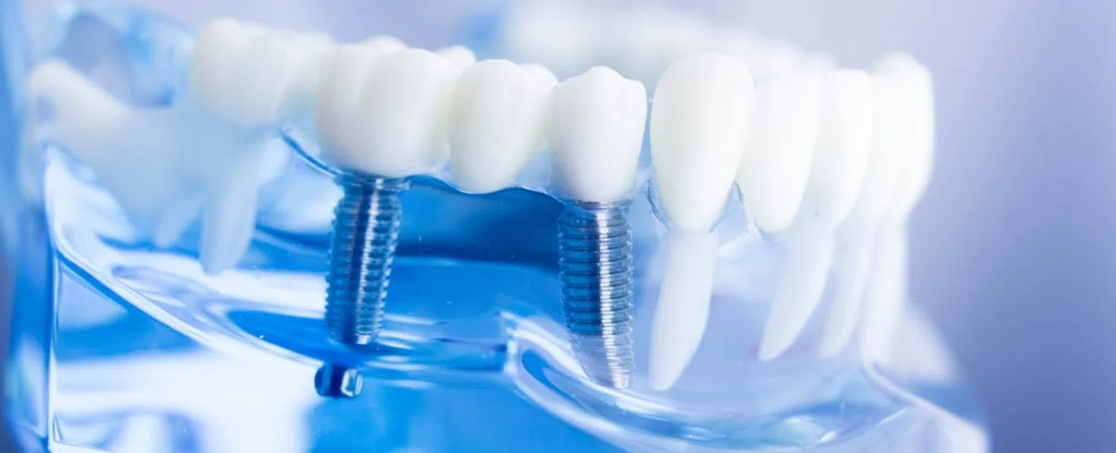 Same-Day Care: How Technology is Revolutionizing Restorative Dentistry