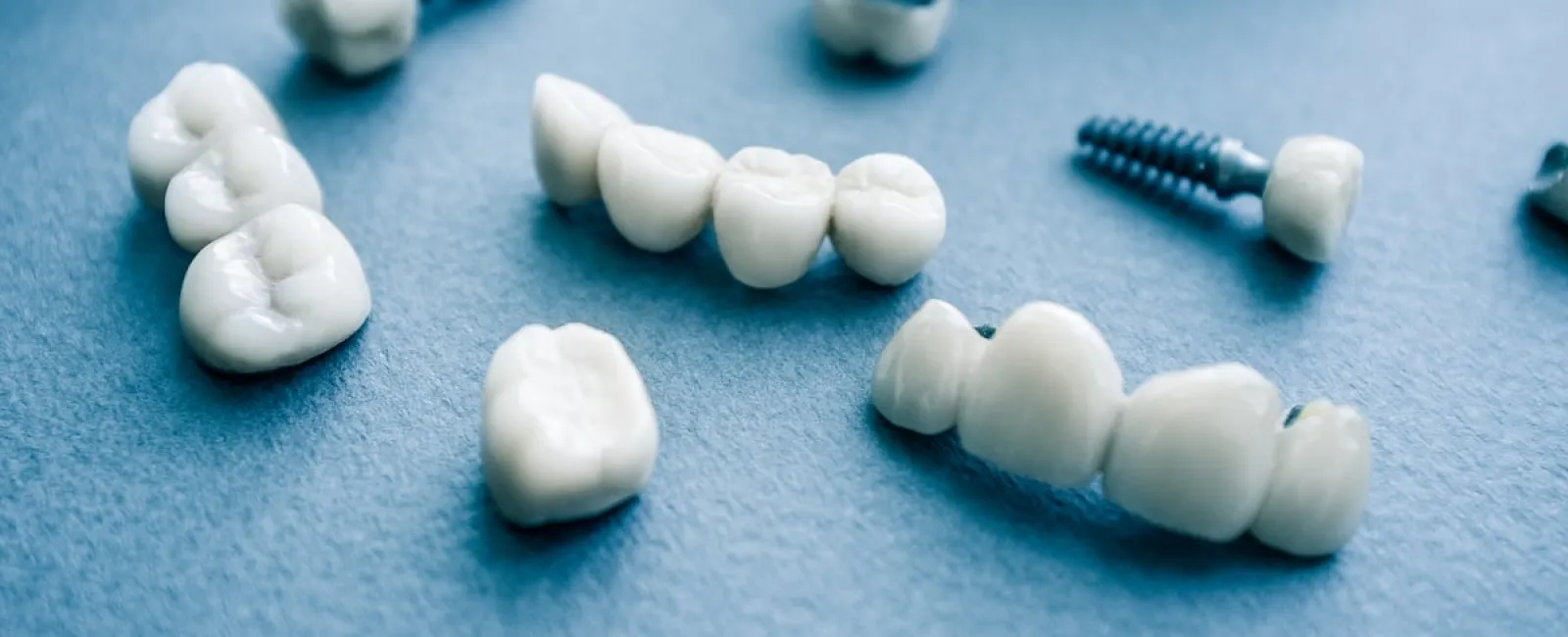 Are Dental Implants Right for You?