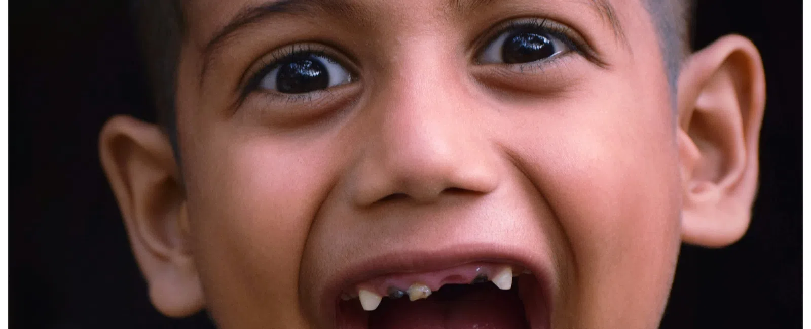 Close-up of a smiling young boy with a shaved head and missing front teeth wearing a blue shirt.
