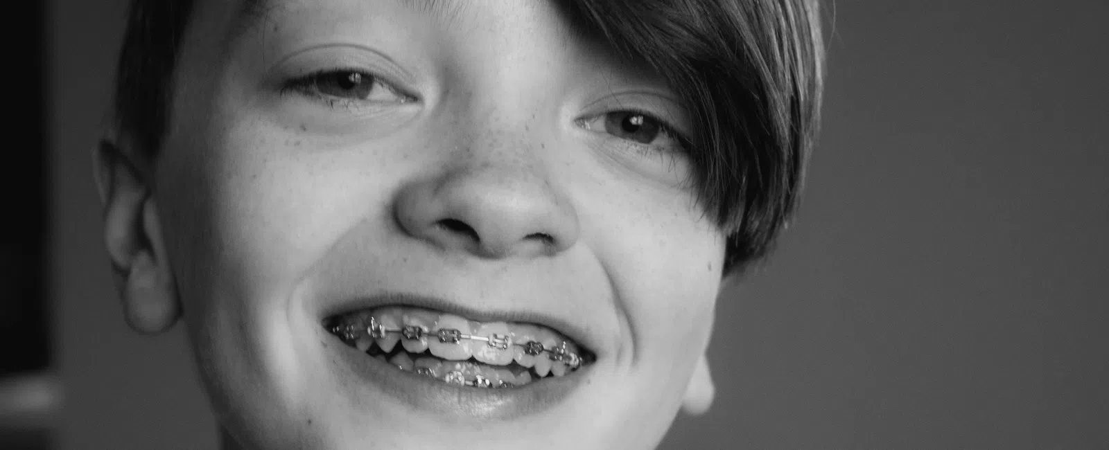 Black and white close-up of a smiling young boy with braces and medium-length hair looking at the camera