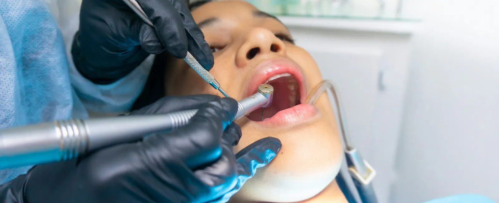 Dentist wearing black gloves treating patient with dental drill and scaler during dental checkup.