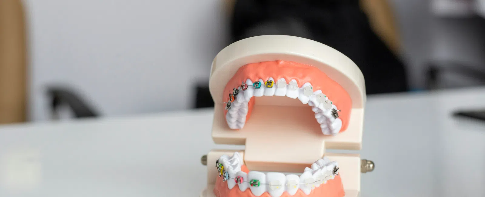 Dental model showing teeth fitted with colorful braces on a white surface in a clinic setting.