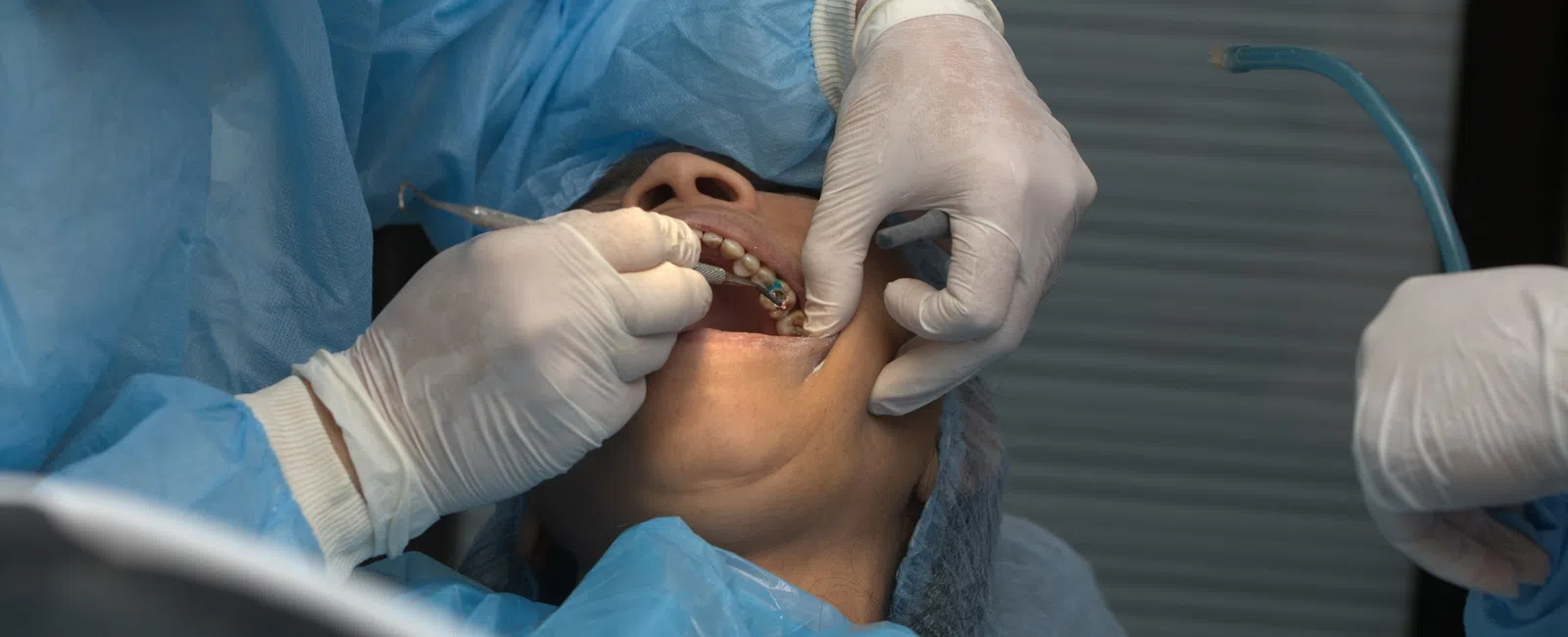 Dentist wearing gloves and blue scrubs performing dental procedure on patient reclining in chair