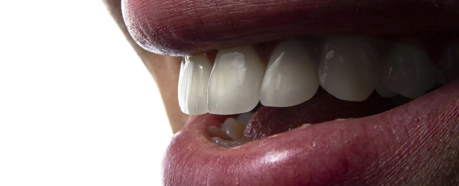 Close-up of a smiling mouth showing white teeth and natural lips against a white background