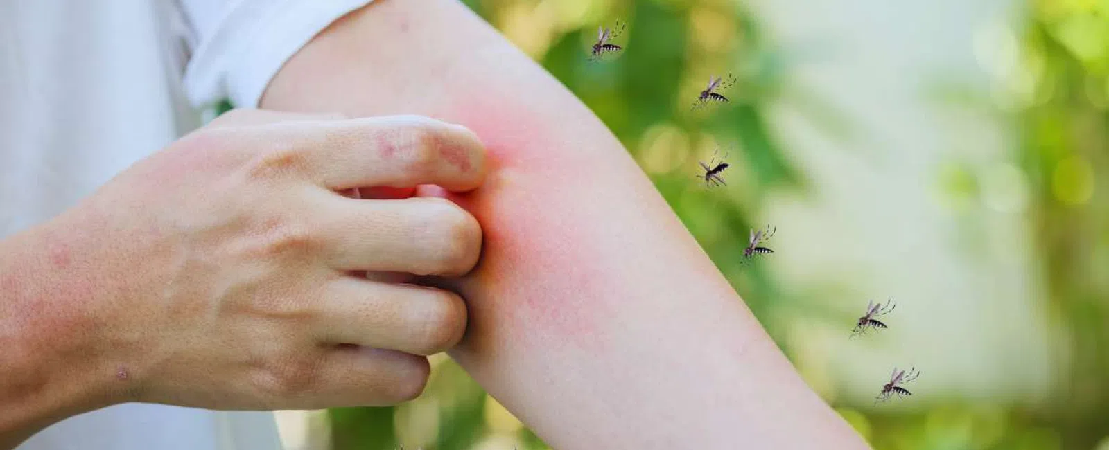Person scratching red, itchy arm surrounded by mosquitoes in a green outdoor setting.