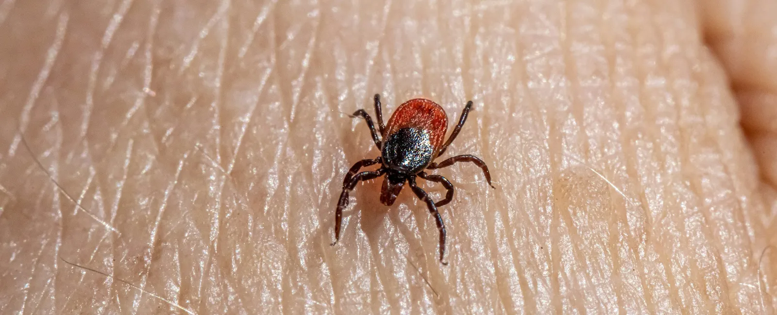 Close-up of a black and red tick crawling on human skin showing detailed texture and body of the parasite