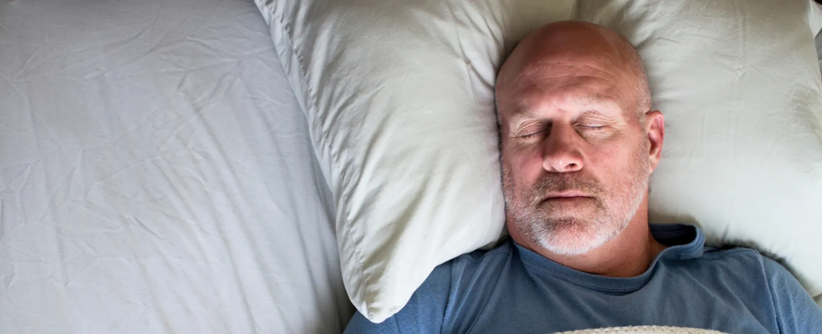 Bald middle-aged man with beard sleeping peacefully on white pillow and blanket wearing a blue shirt.