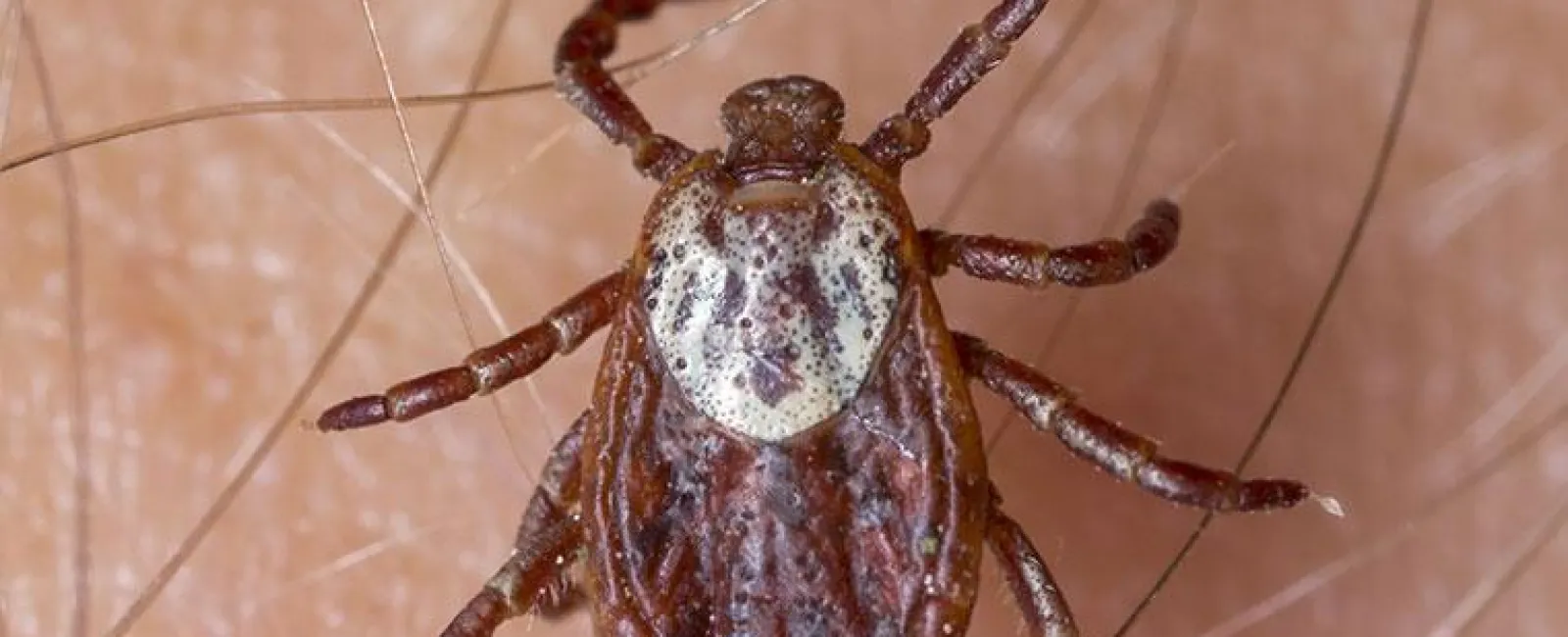 American Dog tick up close