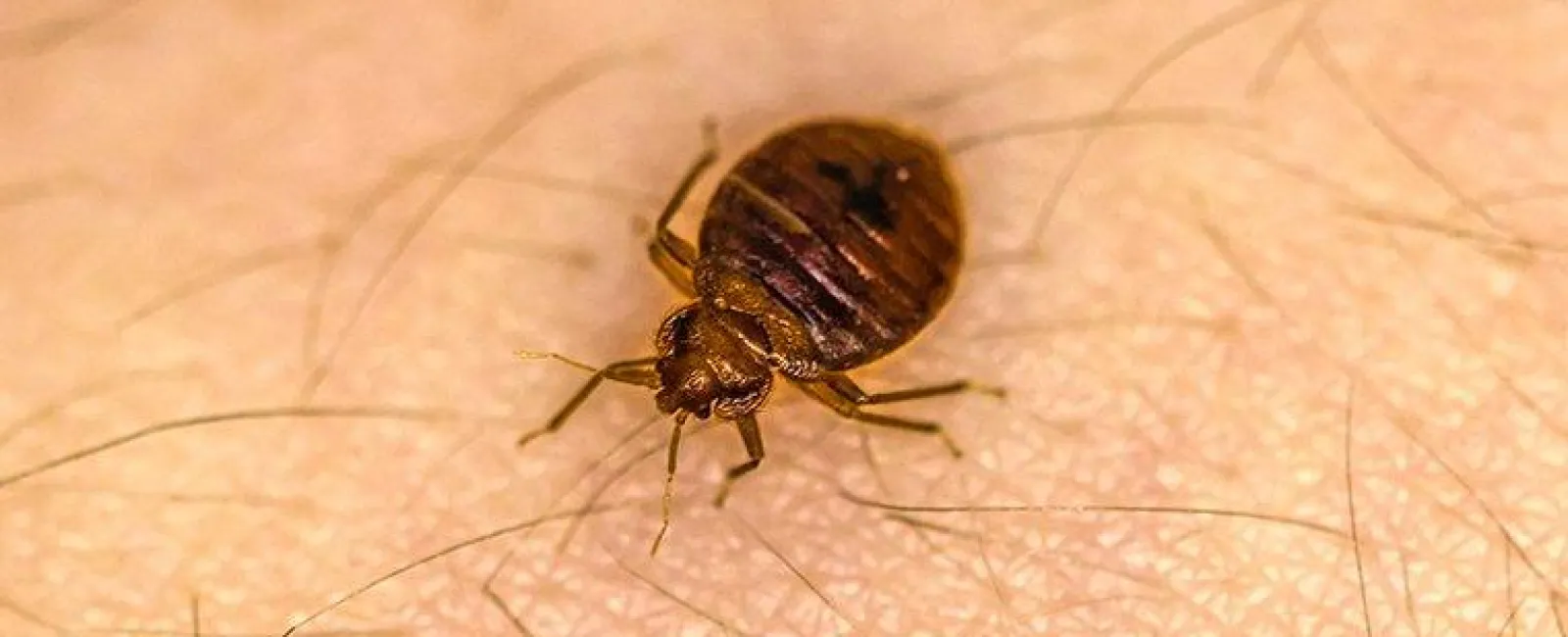 bed bugs crawling on human skin
