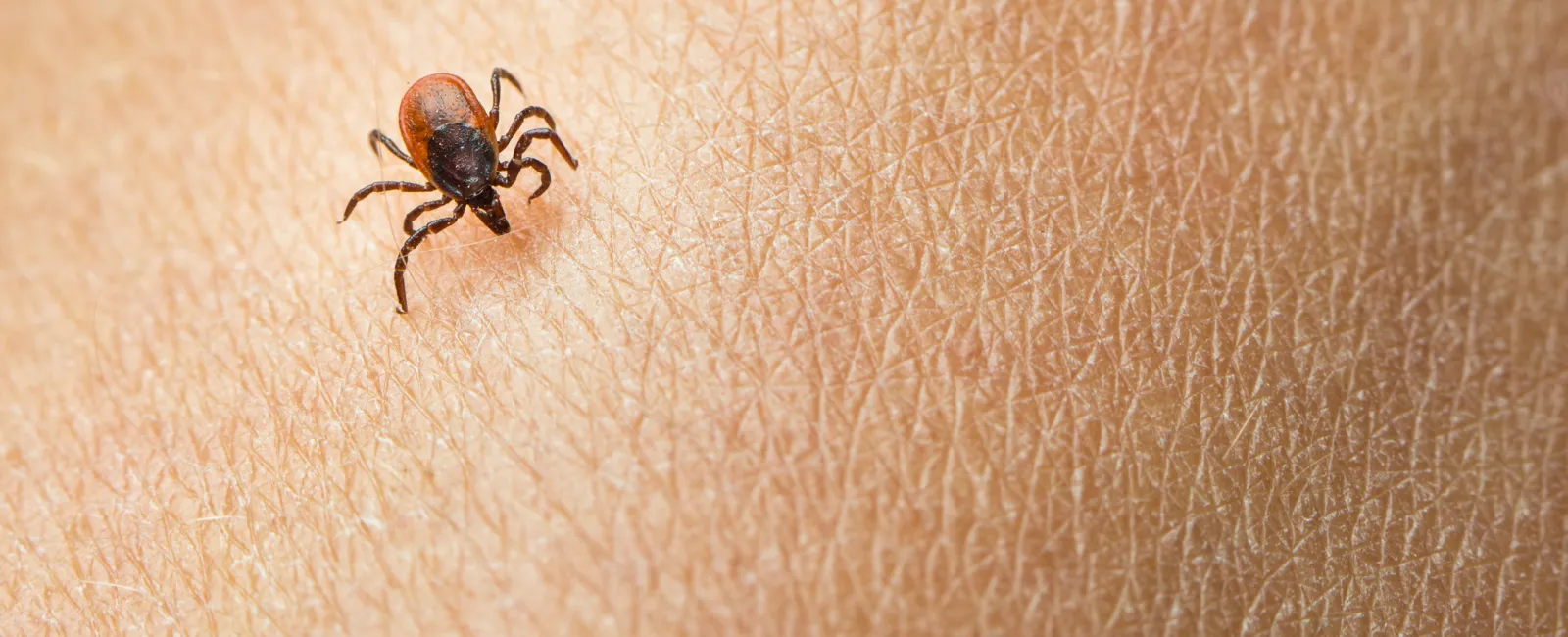 How to Remove a Tick