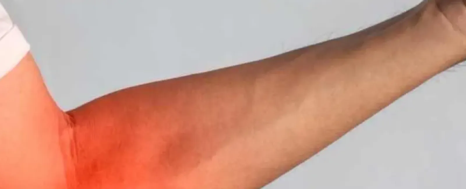 Tennis Elbow vs. Golfer's Elbow: How to Tell the Difference