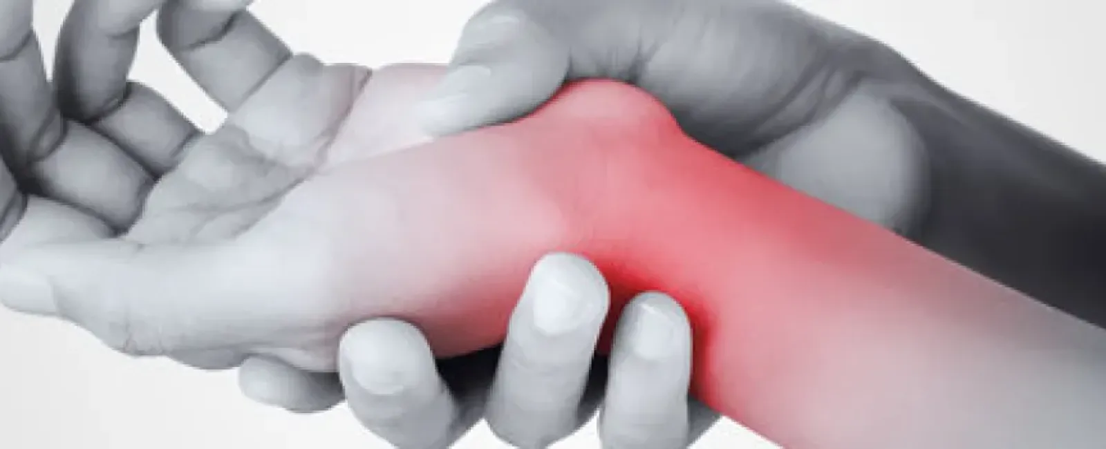 De Quervain’s Syndrome