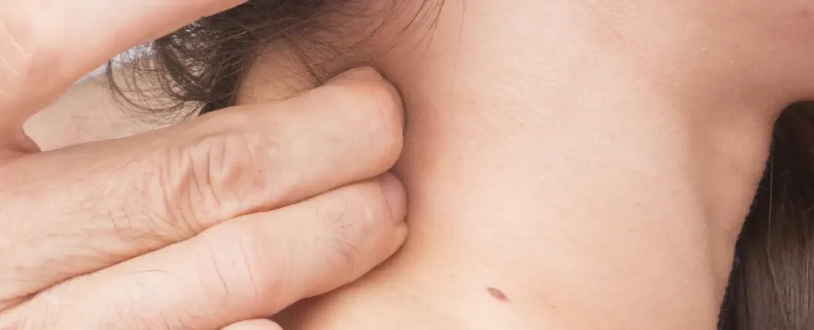 What is Cervical Radiculopathy?