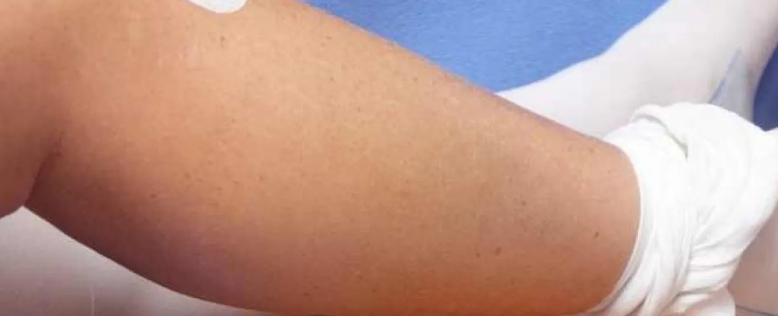 Overcoming Knee Replacement Stiffness: Causes and Remedies