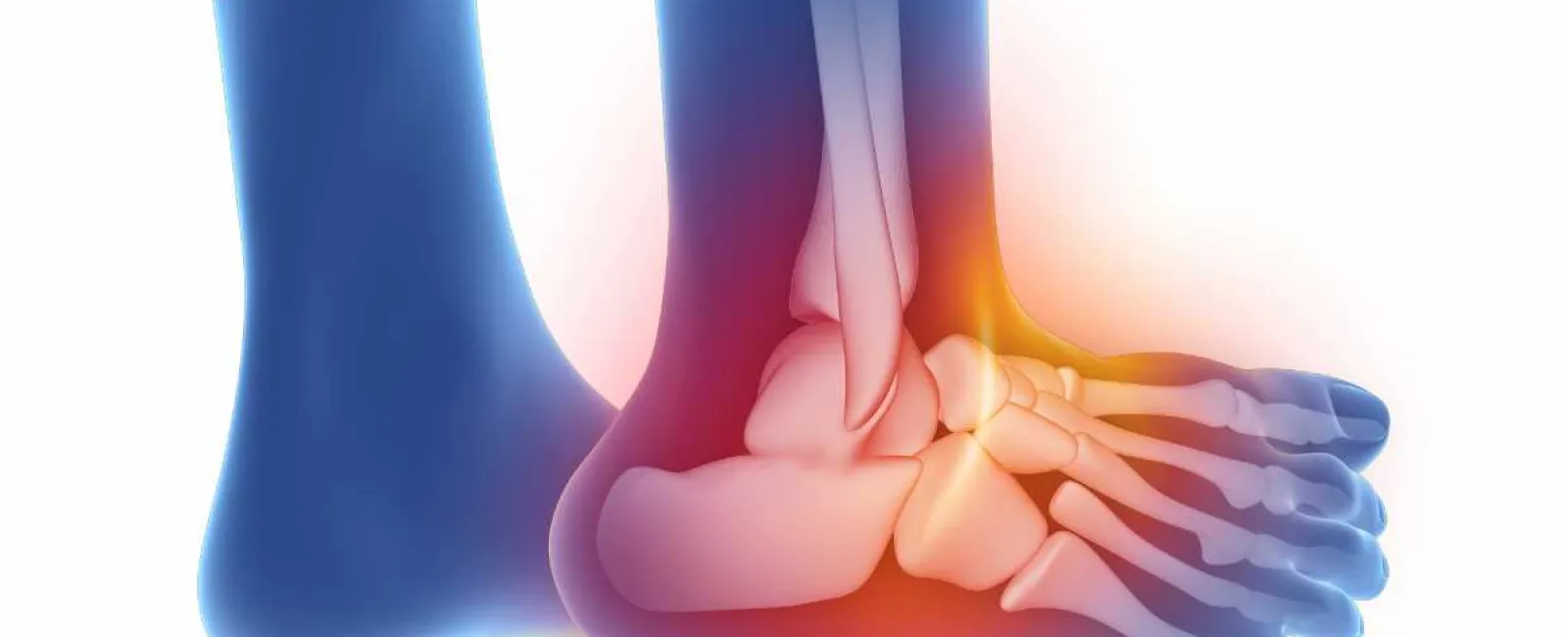 Understanding the Difference between a Sprained and Broken Ankle