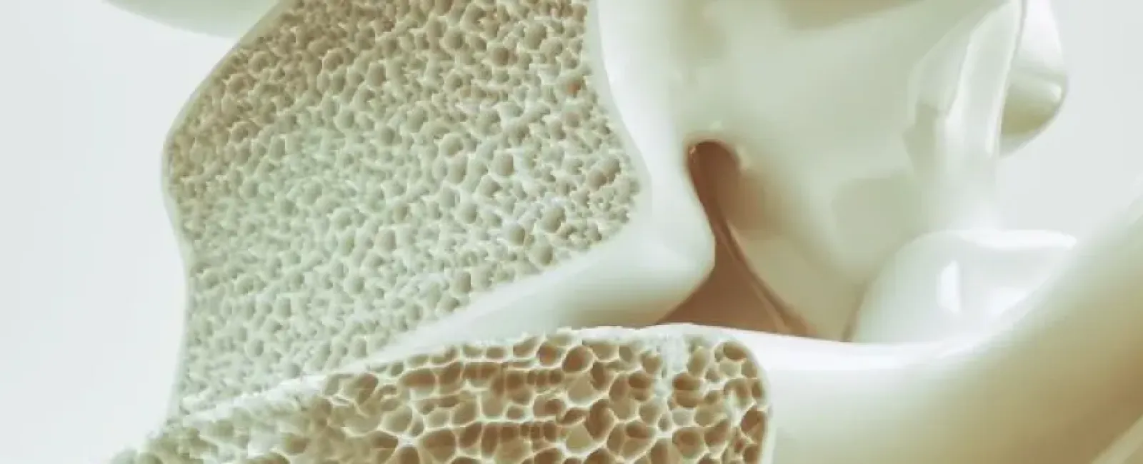 Reduce Your Risk of Fractures with Prolia