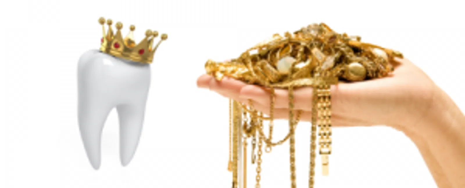 Popular “Crowns” In History