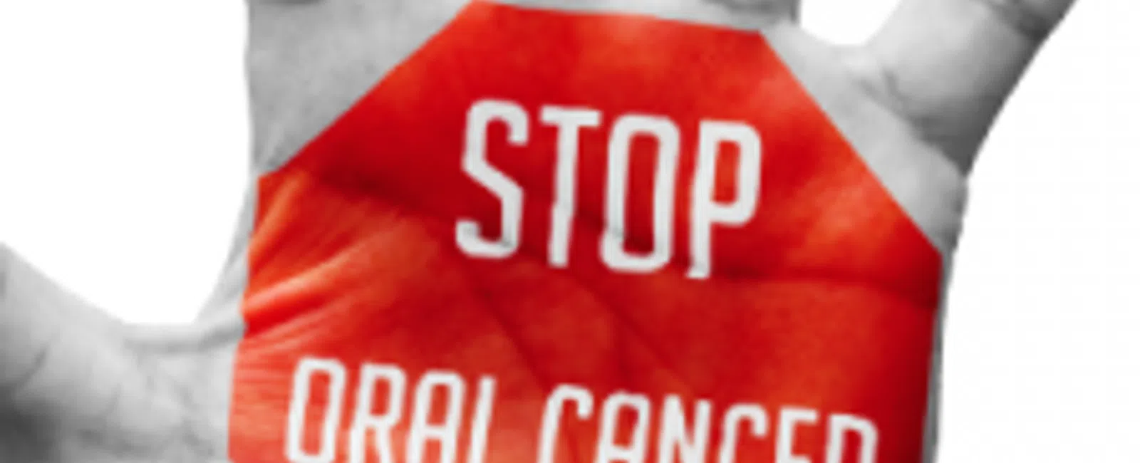 Get Checked, April Is Oral Cancer Awareness Month!