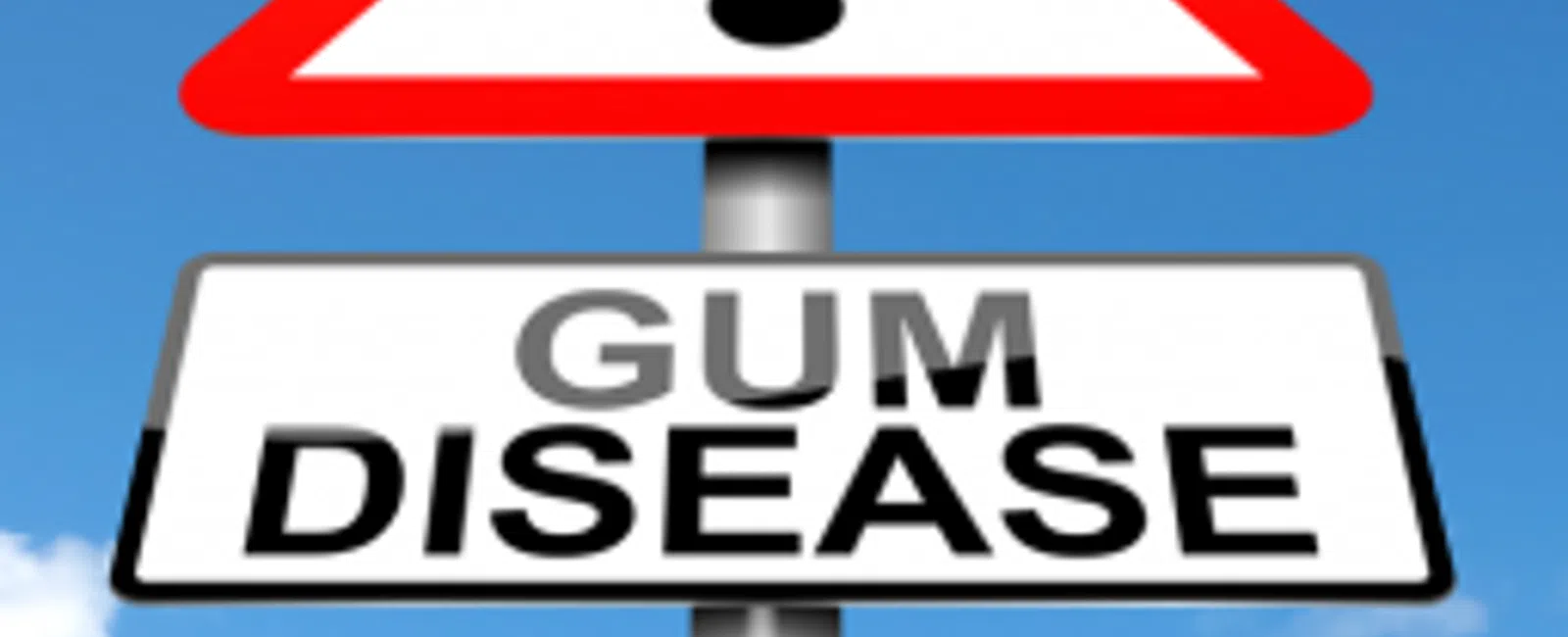 Gum Disease: Locating A Silent Adversary