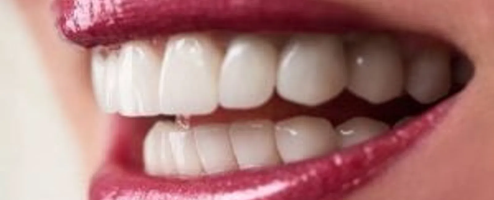 No Teeth? No Problem!