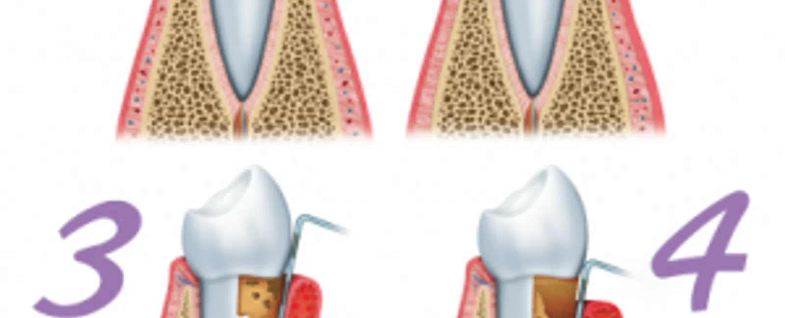 10 Tips To Prevent Gum Disease