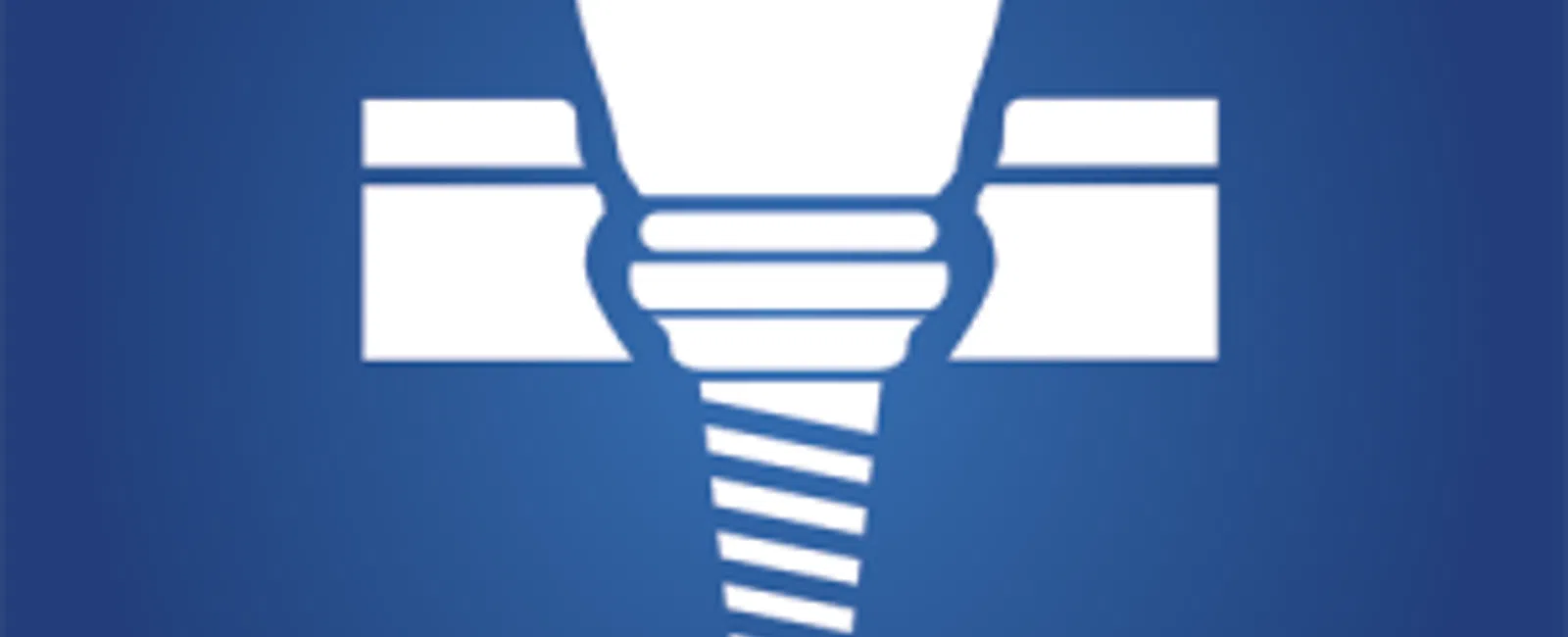 Dental Implants: FAQ