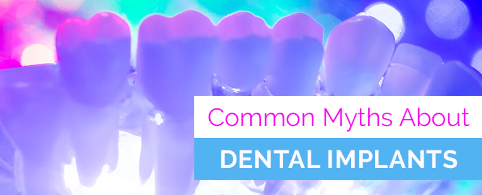 Common Dental Implant Myths