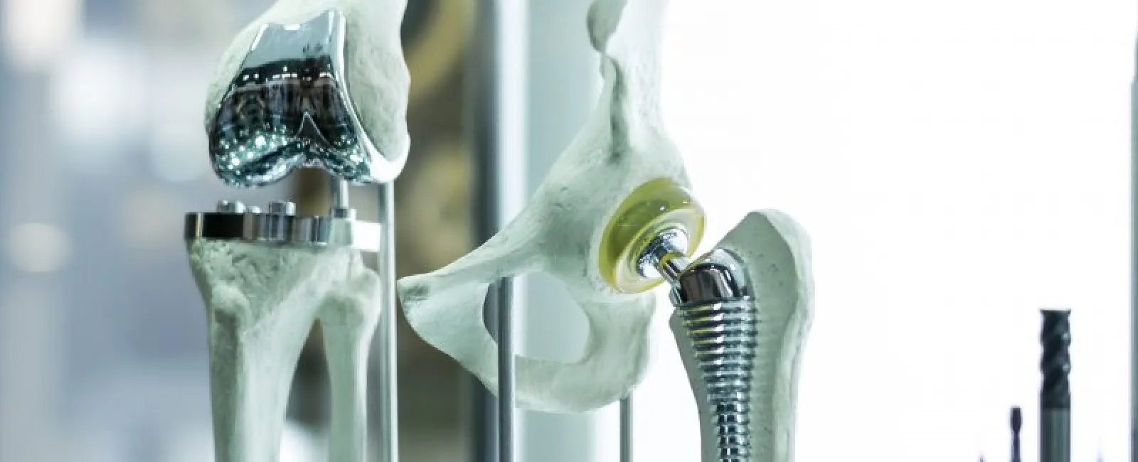 How To Prepare For Joint Replacement Surgery