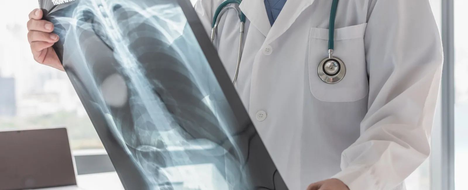 4 Tests for Diagnosing Orthopedic Injuries