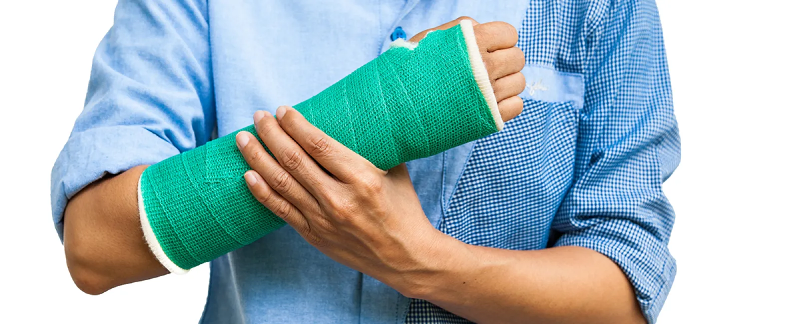 Cast Care: Dos and Don’ts