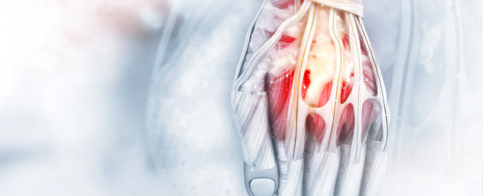 7 Most Common Types of Hand Surgery