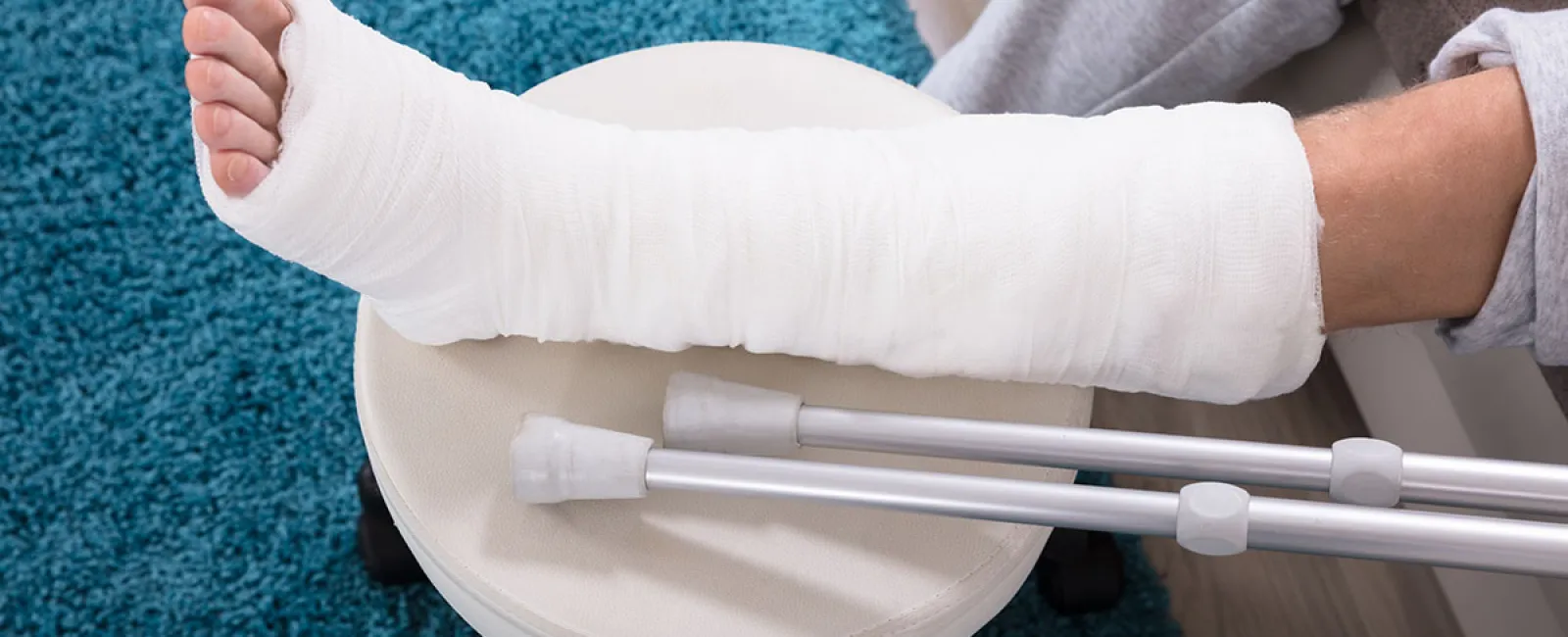 10 Common Types of Bone Fractures