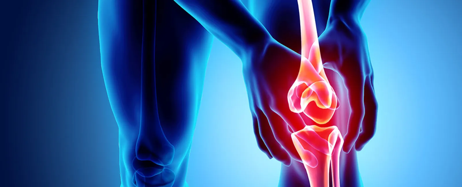 4 Keys to Knee Replacement Recovery