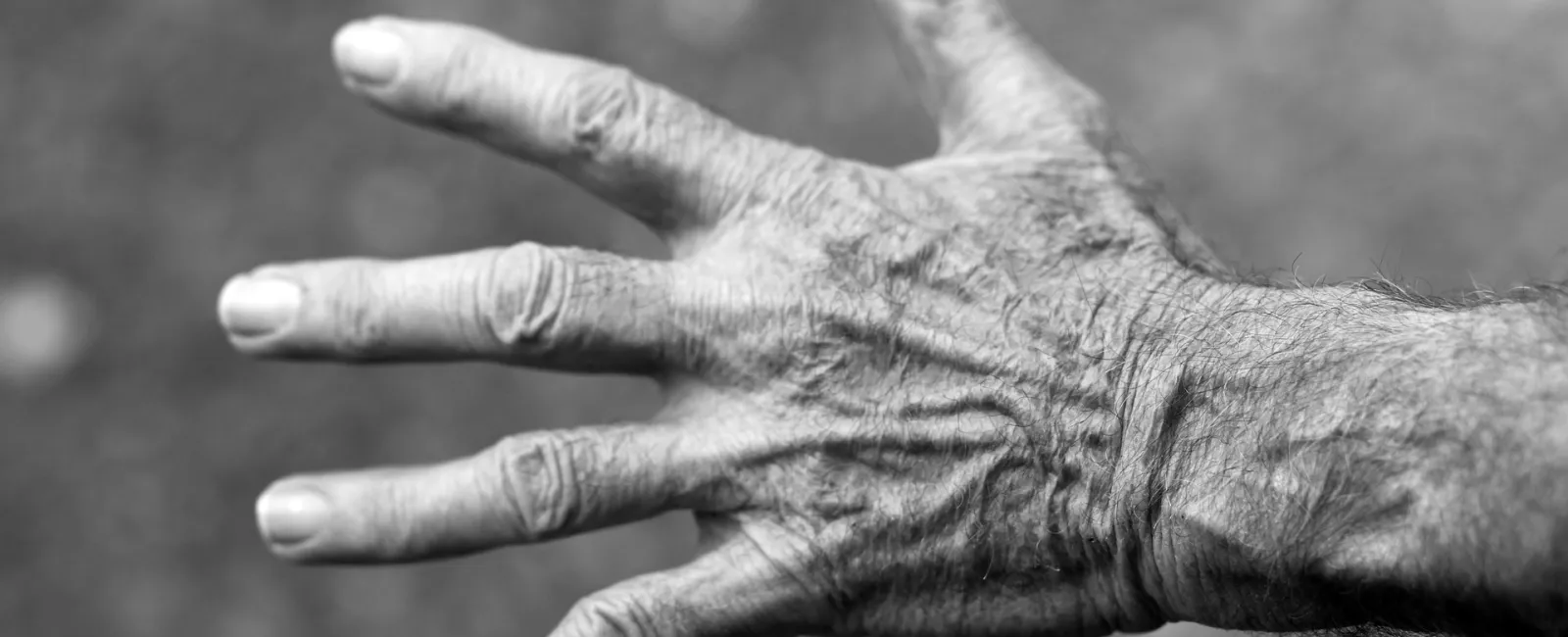 Benefits of Visiting a Hand Surgeon