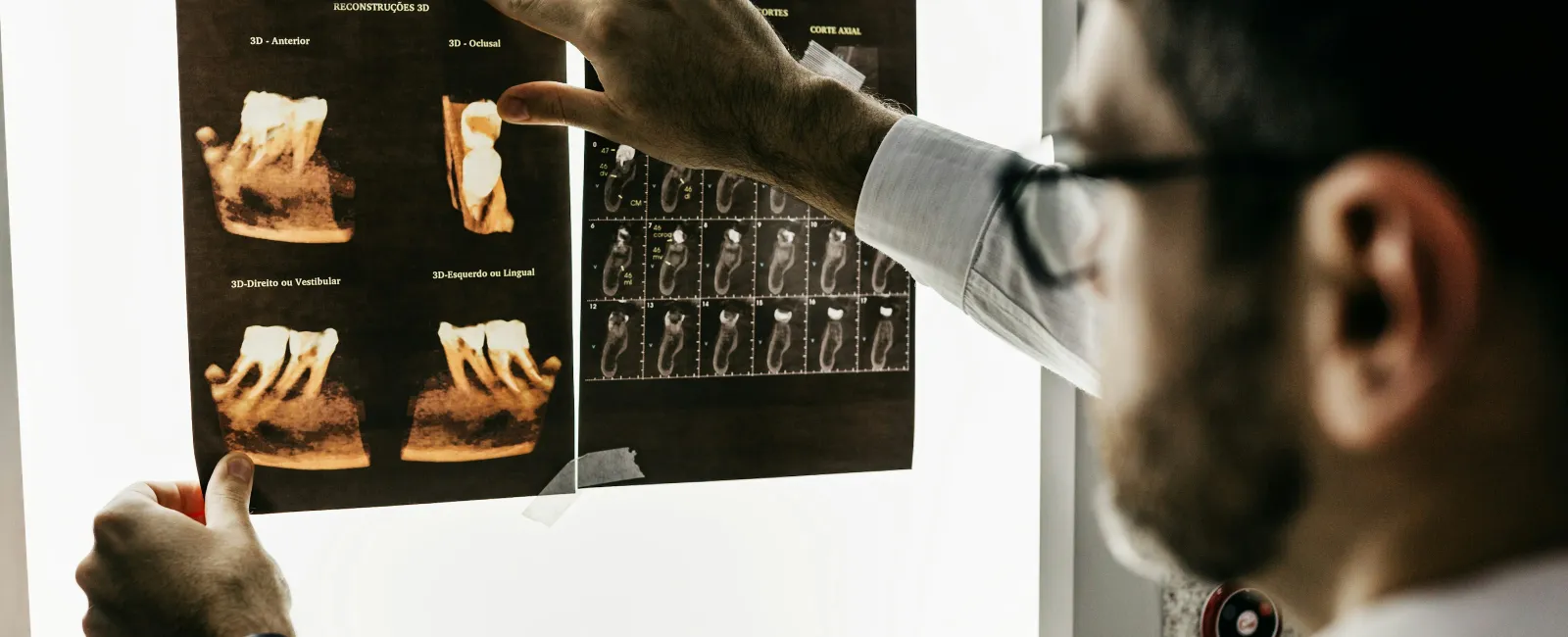 Dentist examining dental X-rays with detailed 3D images of teeth on a lightbox in a clinic setting.