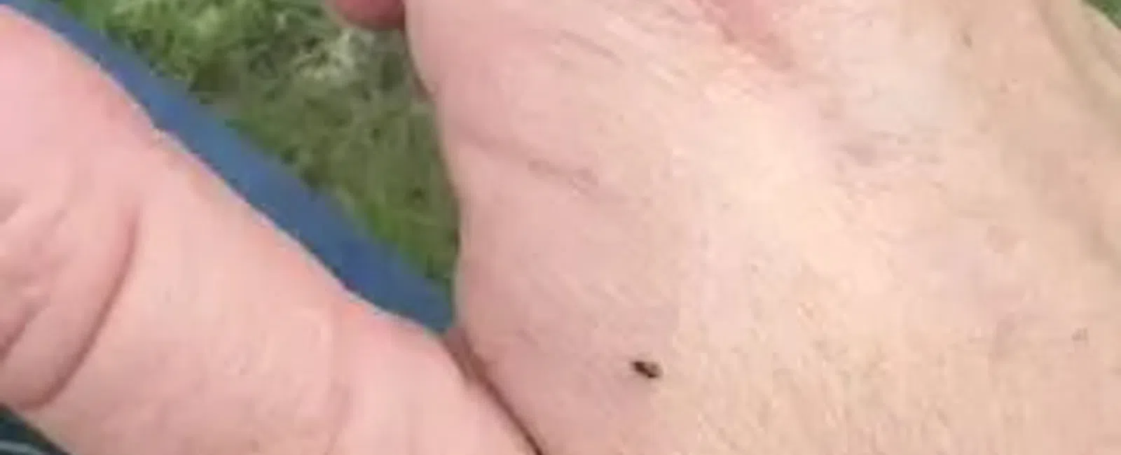 Close-up of a hand with multiple small black flies on the skin against a grassy background.