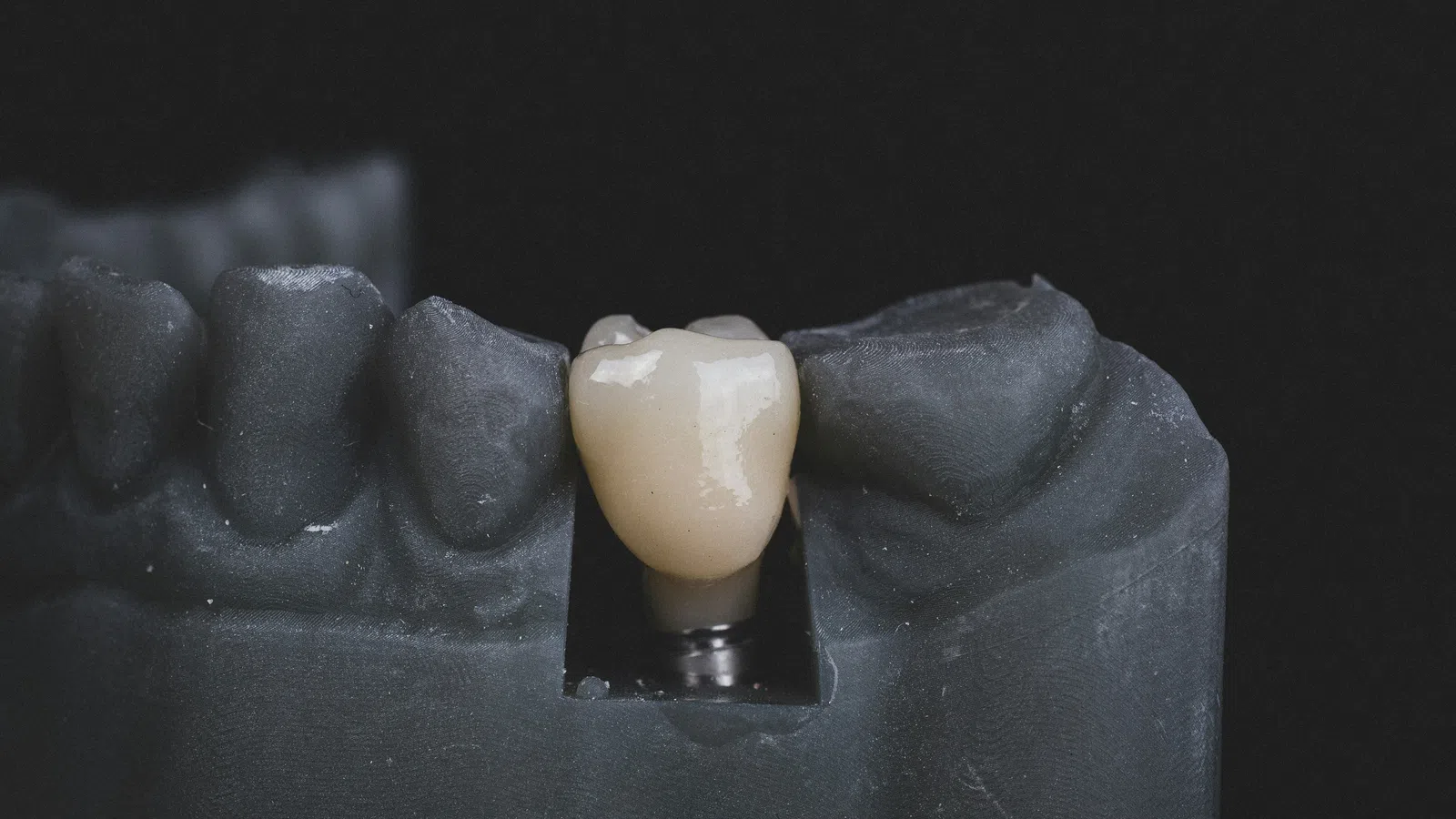 Close-up of a dental implant crown mounted on a black dental model against a black background