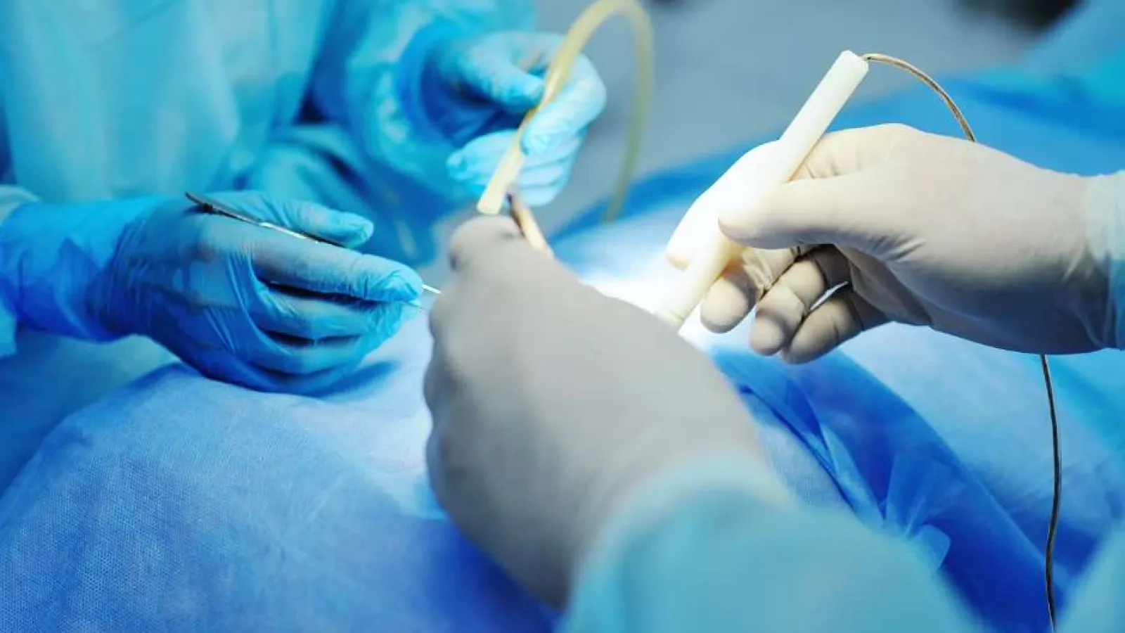 Surgeons wearing gloves performing a surgical procedure with medical instruments on patient draped in blue sterile cloth.