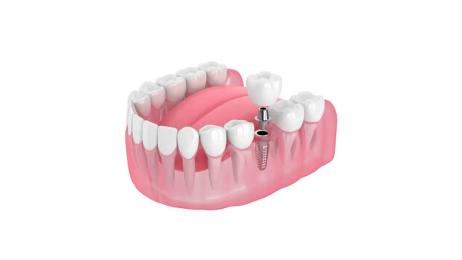a pink and white object
