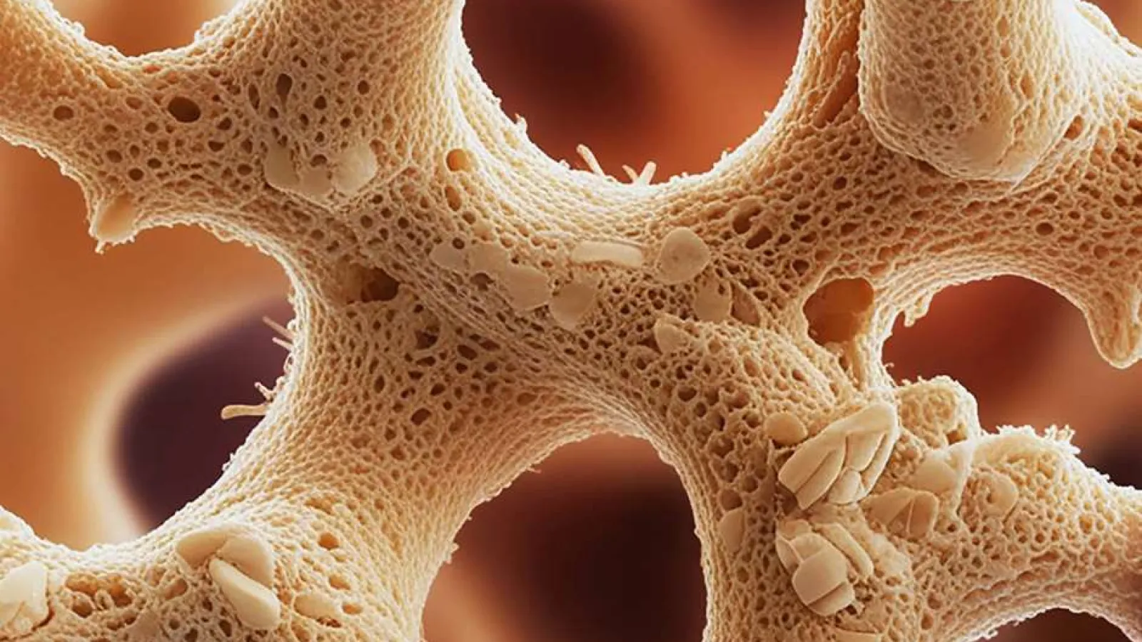 Close-up view of porous human bone tissue showing detailed trabecular structure and cavities.