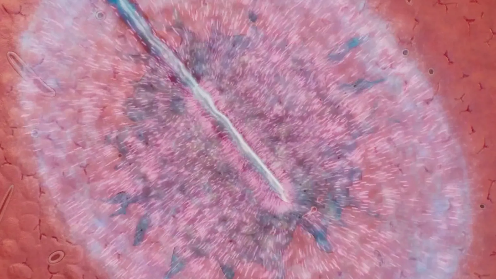 Microscopic close-up of hair follicle embedded in skin tissue with detailed cellular structures visible.
